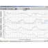 Kép 6/9 - Vezeték nélküli adatgyűjtő, adatlogger, szoftverrel, USB-s, Davis Instruments Weather Link®