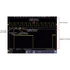 Kép 38/57 - VOLTCRAFT DSO-5104H Kézi oszcilloszkóp Kalibráció (ISO) 100 MHz 4 csatornás 1 GSa/mp 40 Mpts 14 bit Digitális memória (D